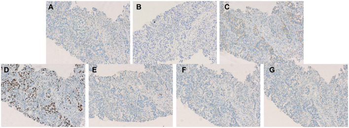 Figure 4