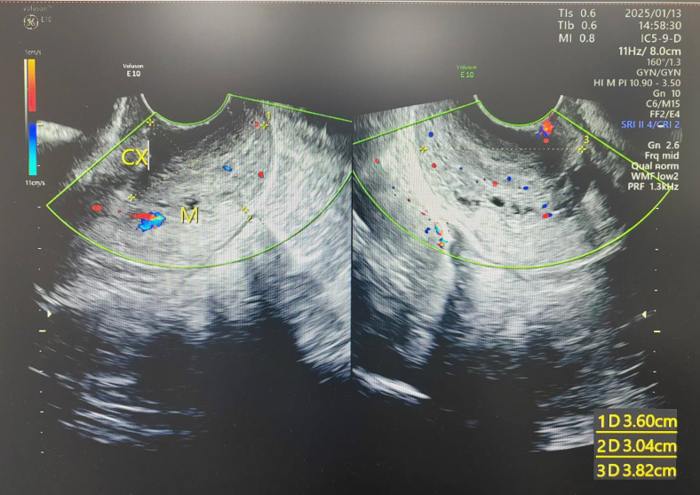 Figure 2