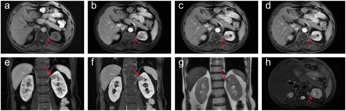 Figure 2