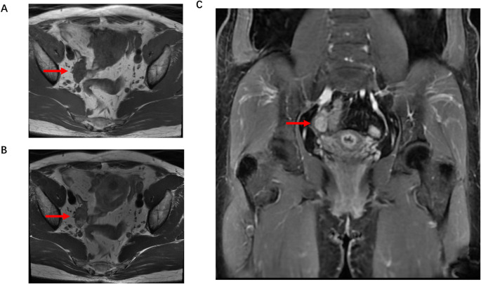 Figure 2