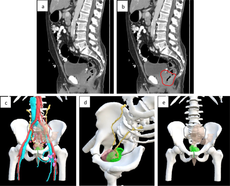 Figure 1