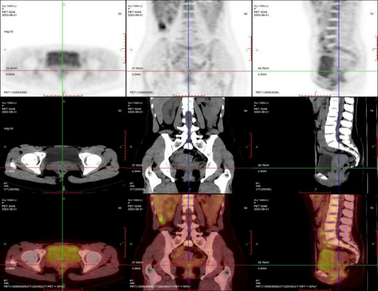 Figure 2