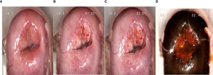Figure 3
