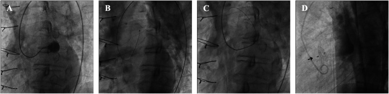 Figure 3