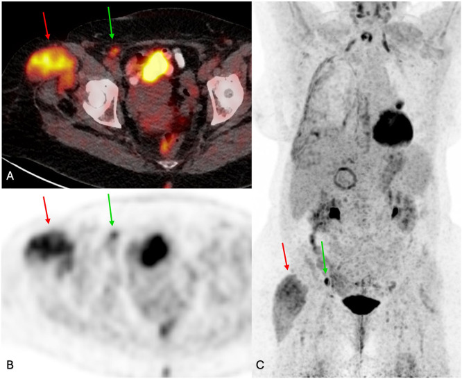 Figure 2