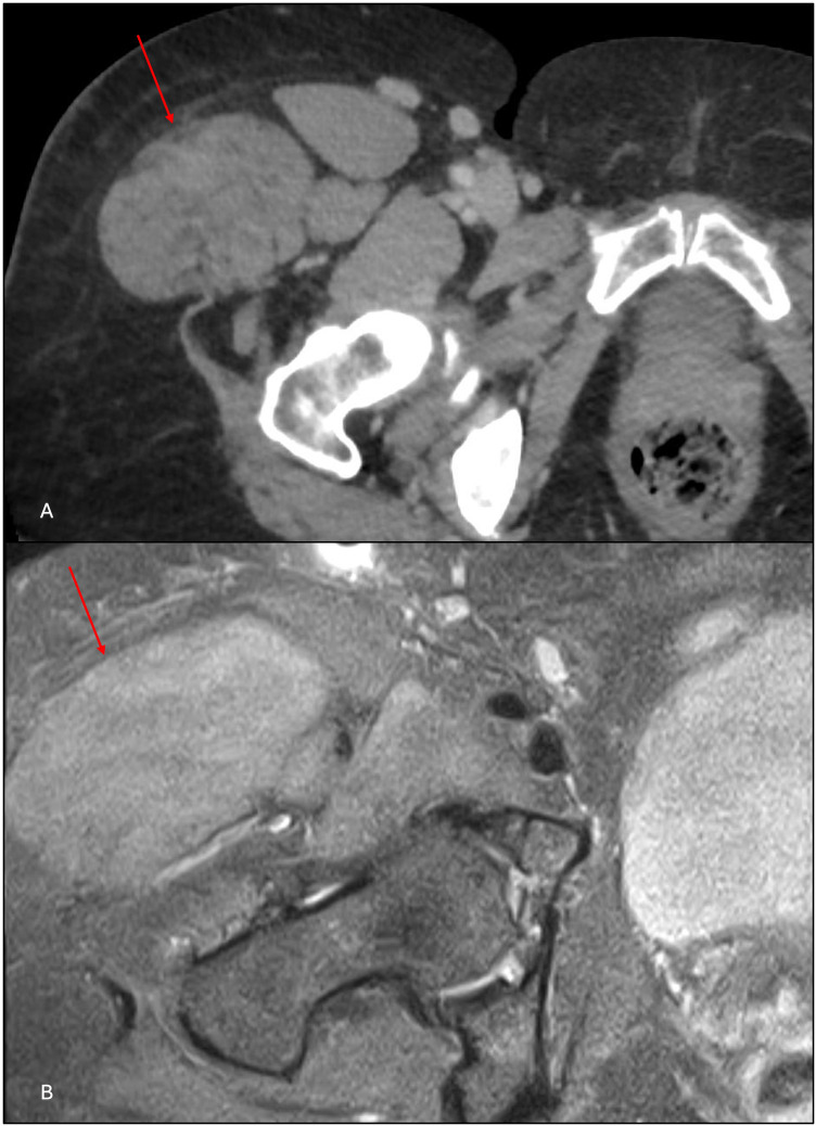 Figure 4