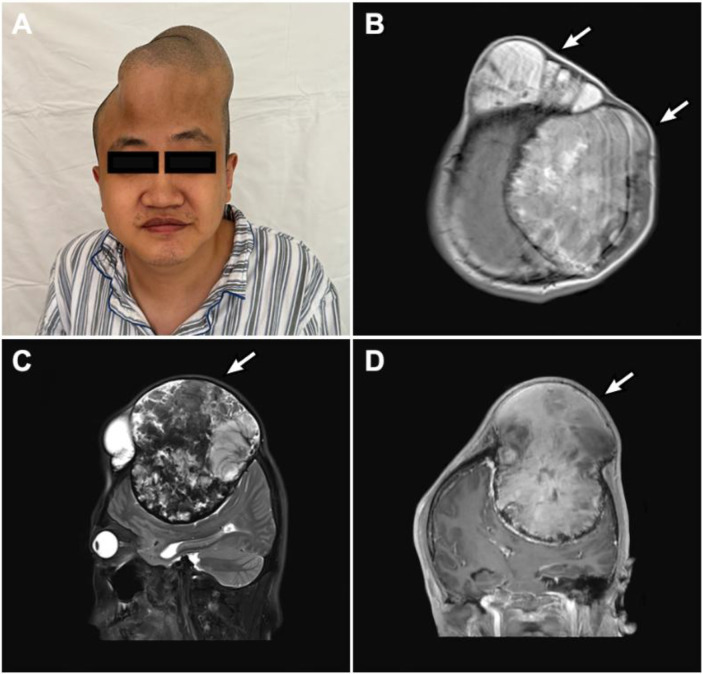 Figure 1