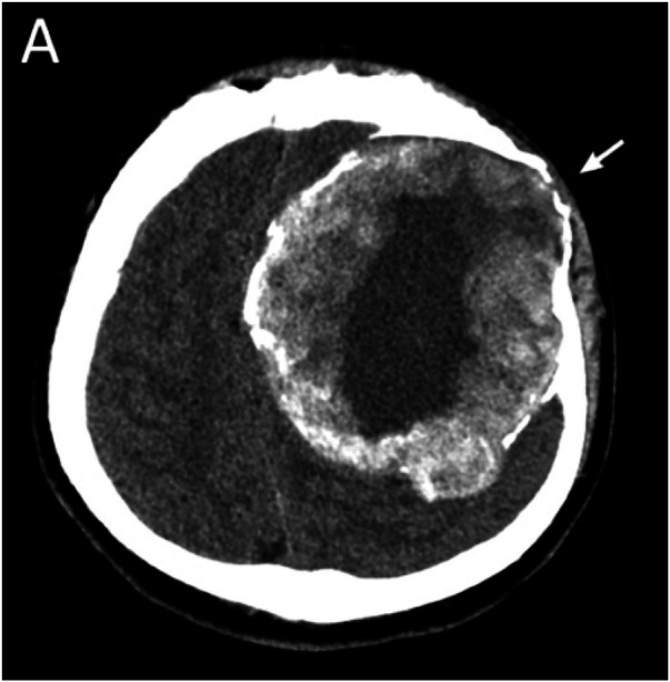 Figure 2
