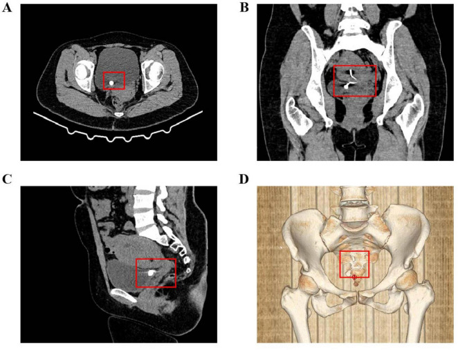FIGURE 1