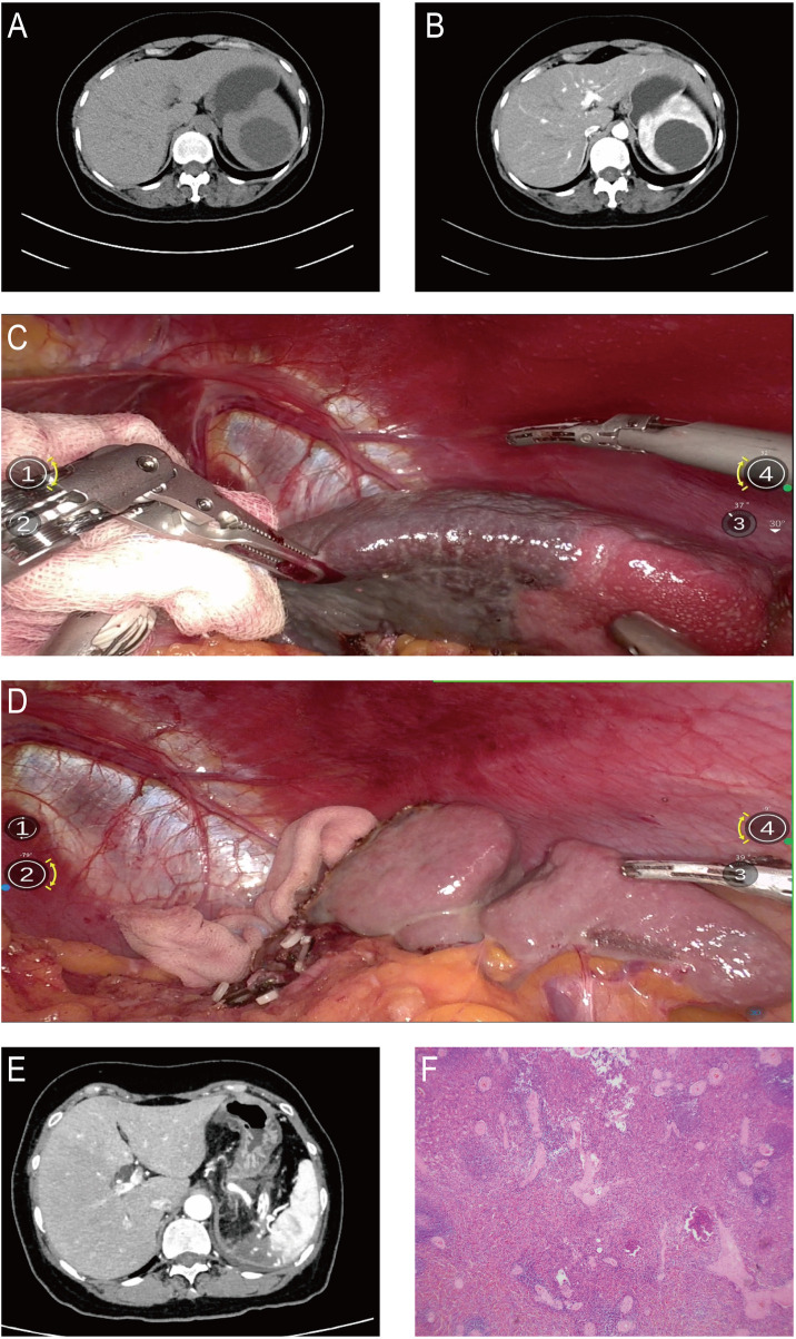 Figure 2