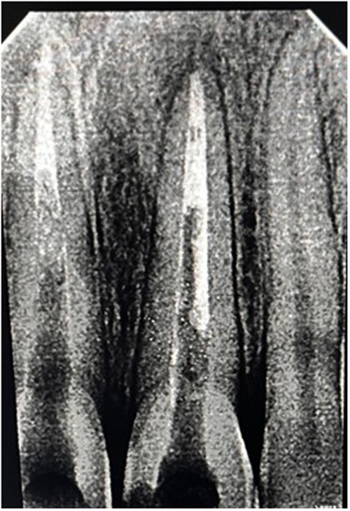 Figure 4