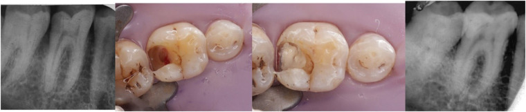 Figure 9