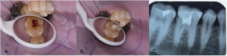 Figure 10
