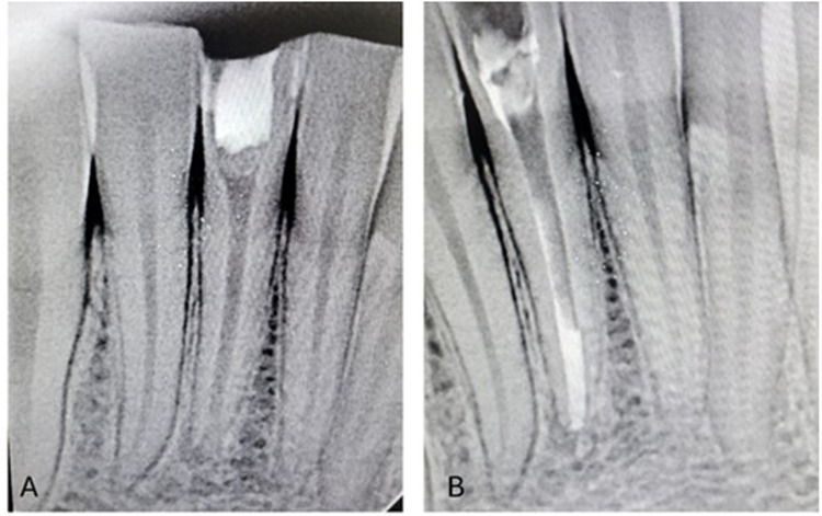 Figure 11