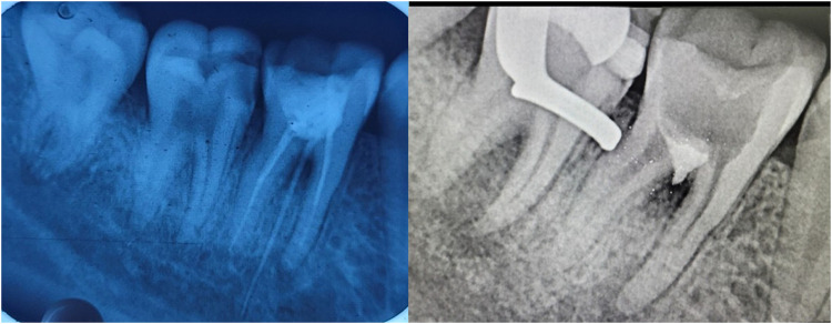Figure 12