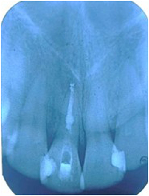 Figure 13