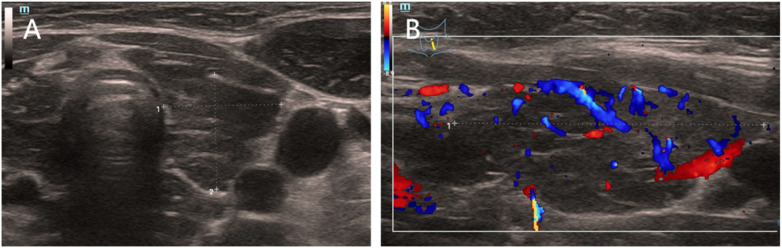 Figure 2