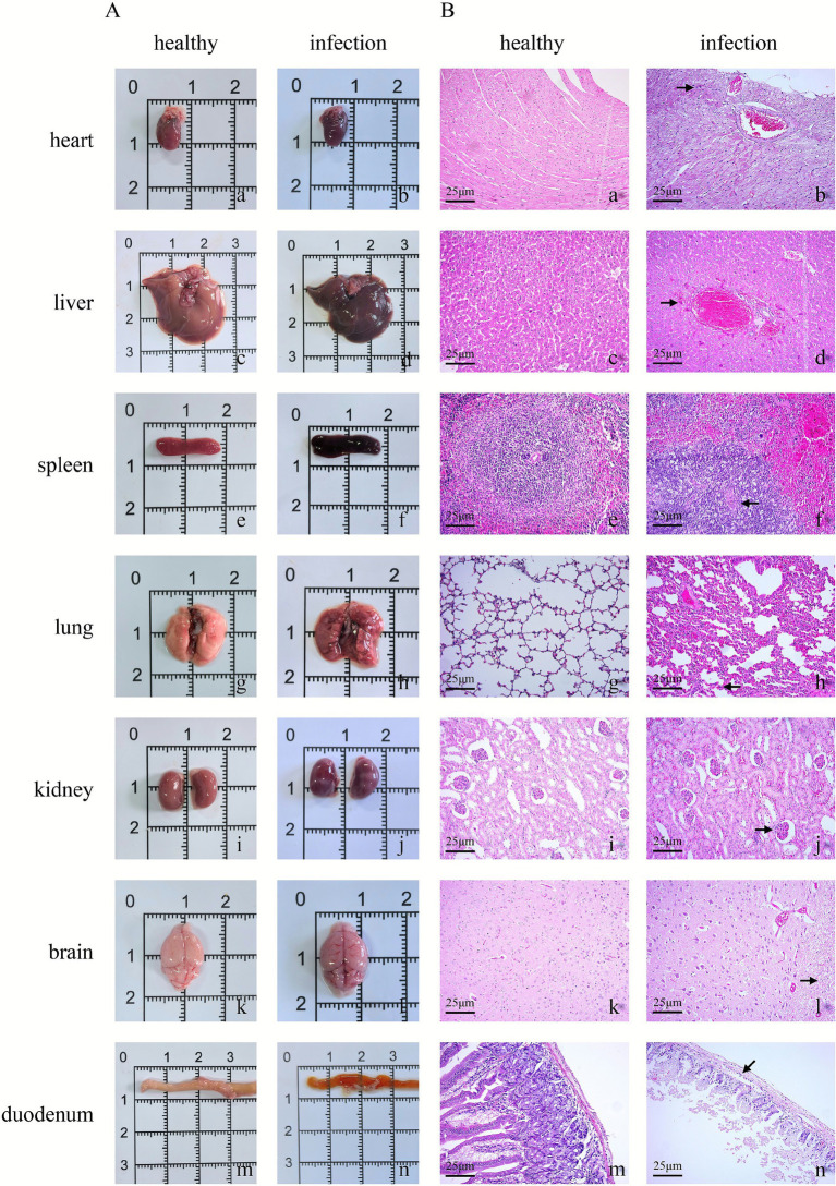 Figure 13