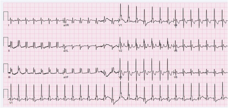 Figure 1