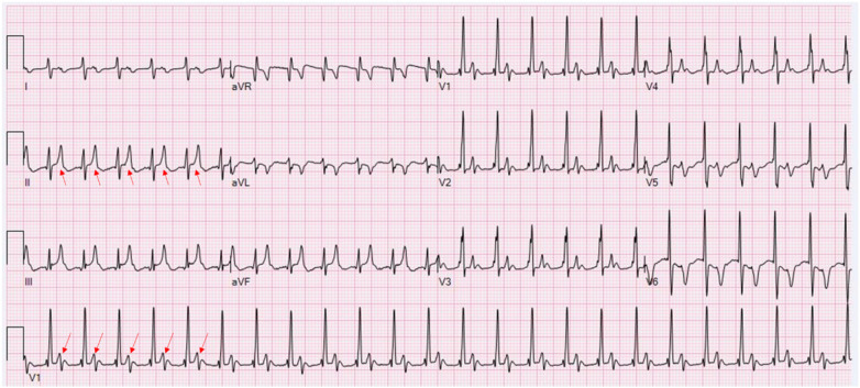 Figure 2