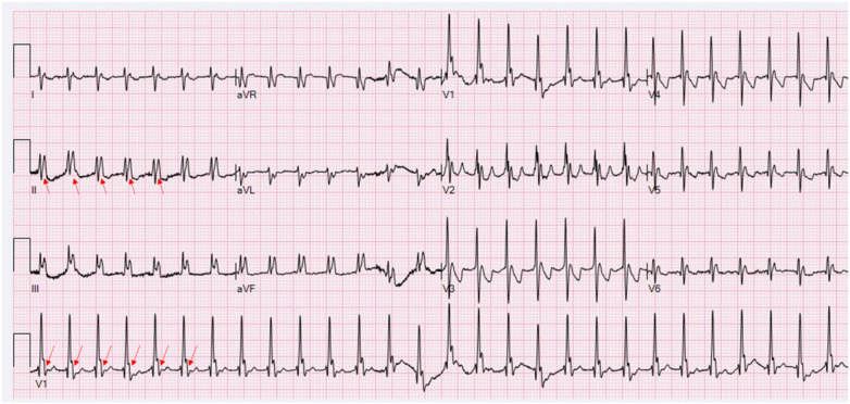 Figure 3