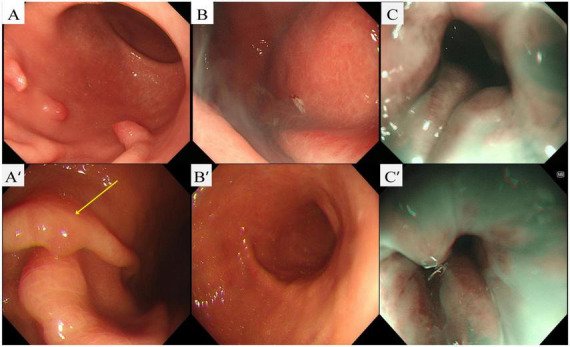 FIGURE 1