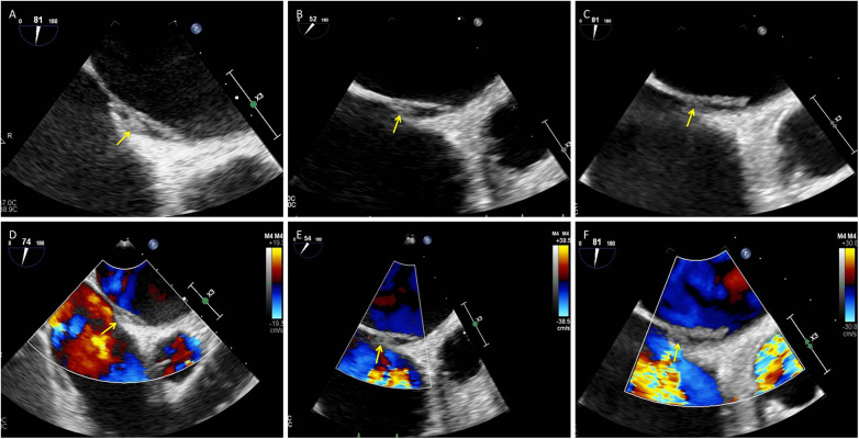 Figure 2