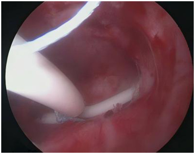 Figure 11