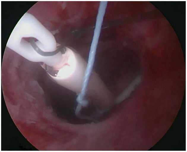 Figure 12