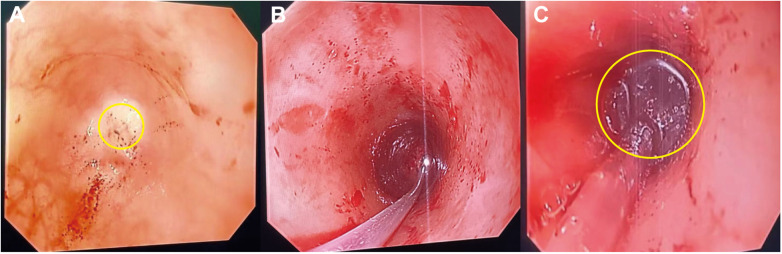 Figure 2