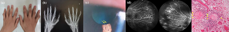 Figure 1
