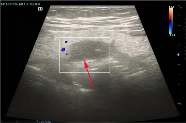 Figure 1