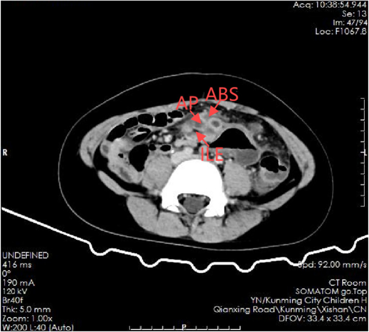 Figure 2