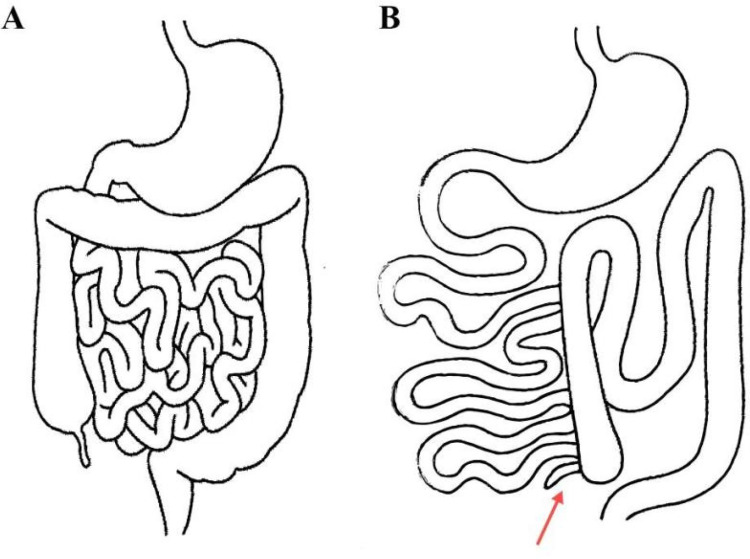 Figure 3