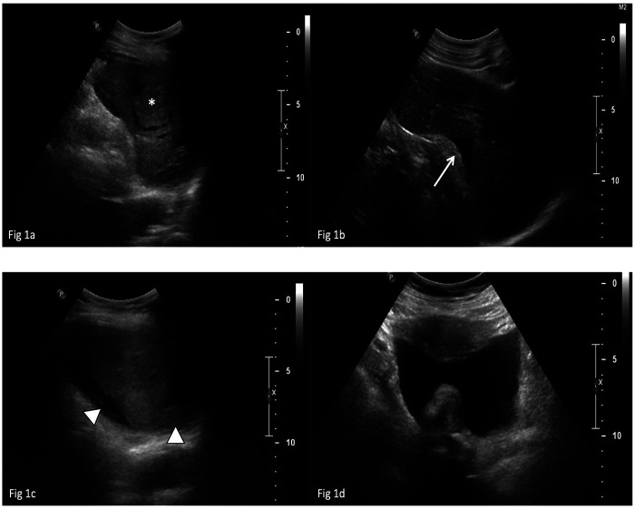 Figure 1