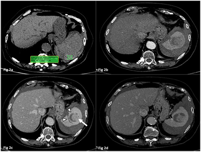 Figure 2