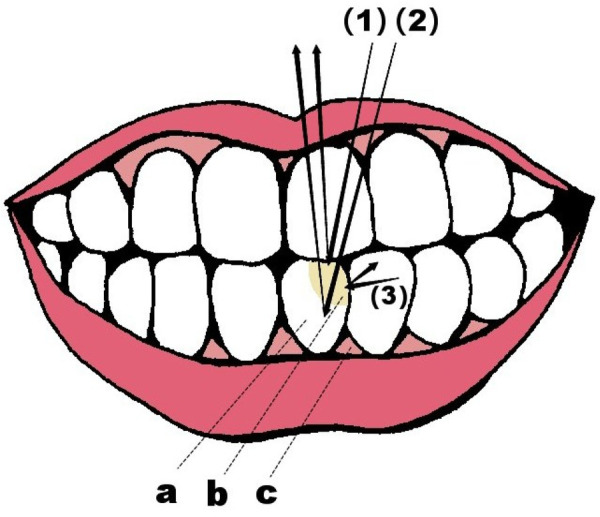 Figure 1