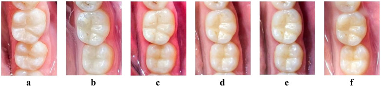 Figure 3