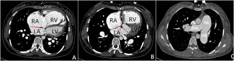 Figure 2
