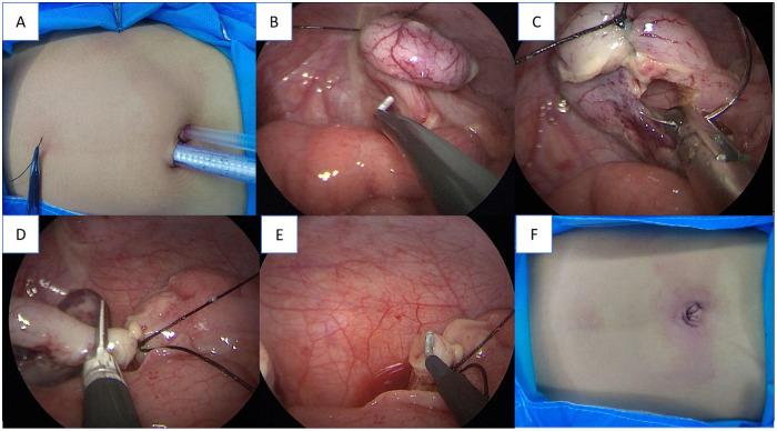 Figure 2