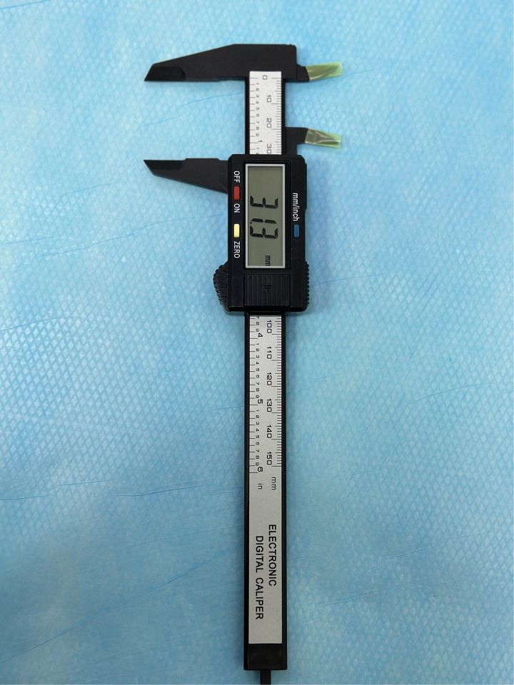 Figure 2