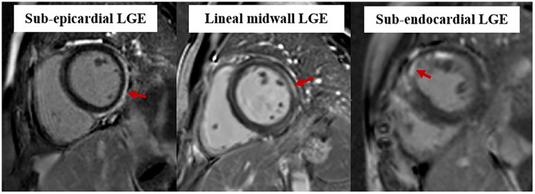 Figure 3