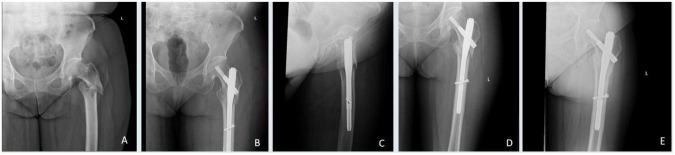 FIGURE 2