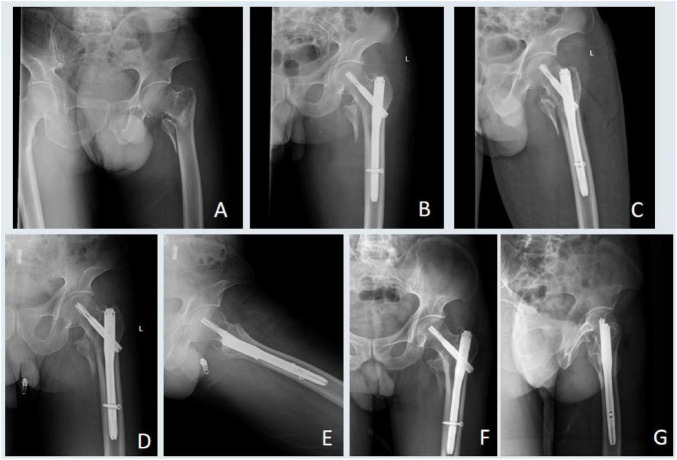 FIGURE 3