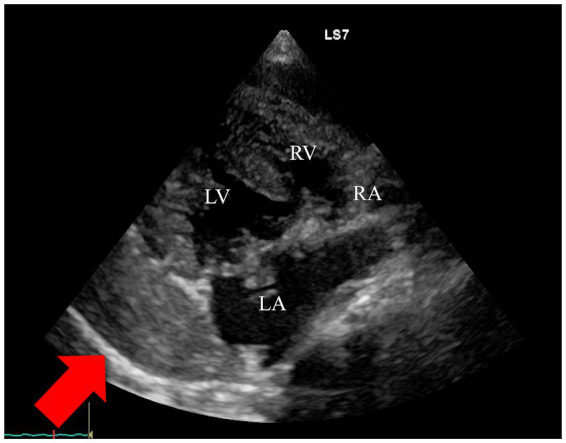 Figure1