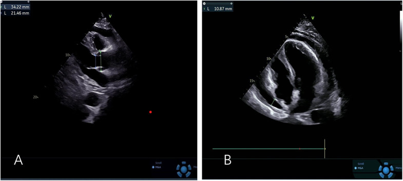 Figure 1