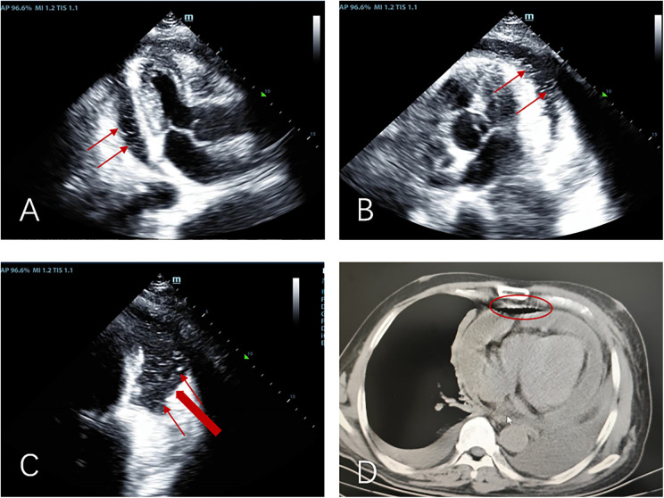 Figure 2