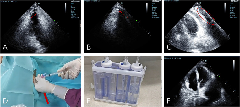 Figure 3
