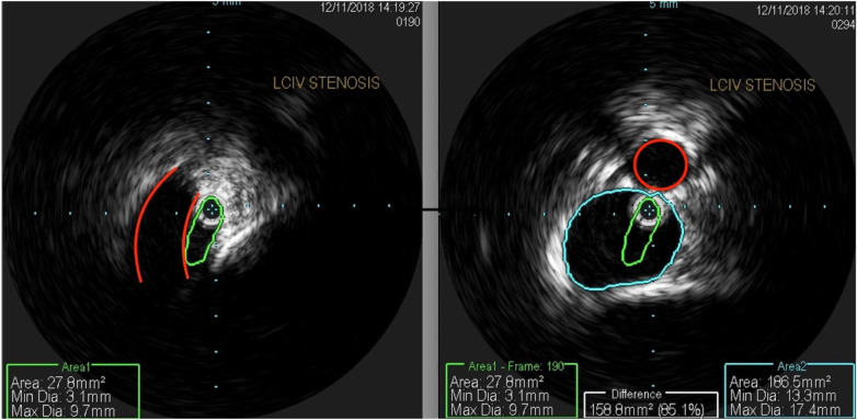Figure 3