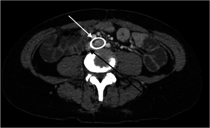 Figure 4